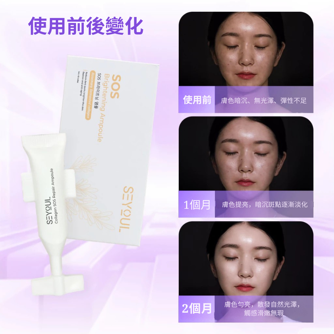 SEYOUL亮肤精华 (SOS Brightening Ampoule) – 1ml x 15支